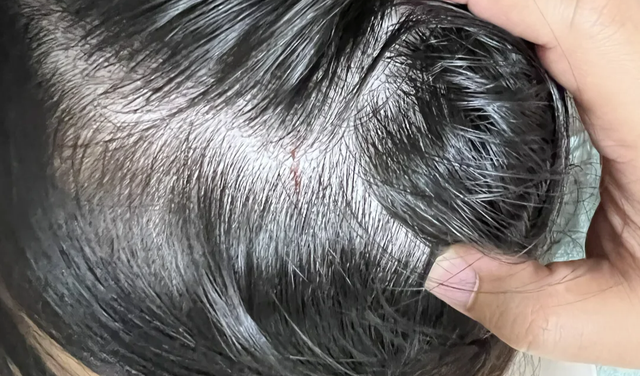 不是吓唬你，不注意这8个装修细节，入住后必定后悔！-19.jpg